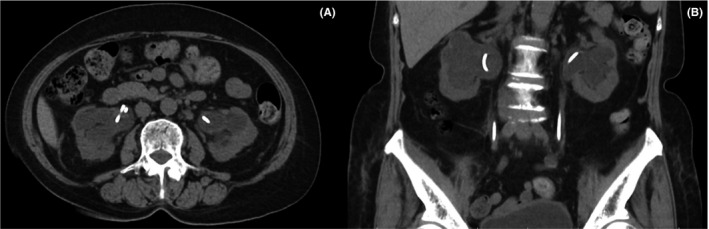 FIGURE 1