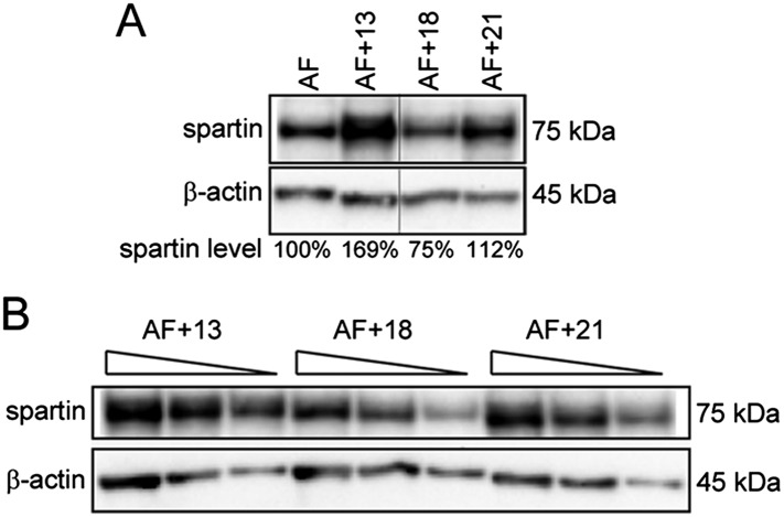 Figure 4—figure supplement 1.