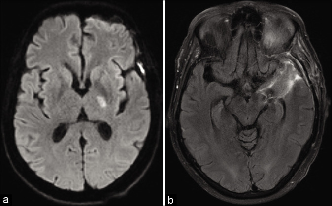 Figure 4: