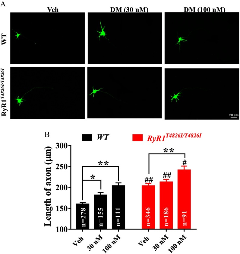 Figure 9A are representative images of WT and R yR1 super T4826I virgule T4826I mutation neurons that were exposed to V e h and deltamethrin. Figure 9B shows two bar graphs plotting length of axon at 100, 150, 200, 250, and 300 micrometers (y-axis) for WT and R yR1 super T4826I virgule T4826I across exposures V e h and deltamethrin 30 and 100 nanomolars (x-axis), representing data as standard error of mean.