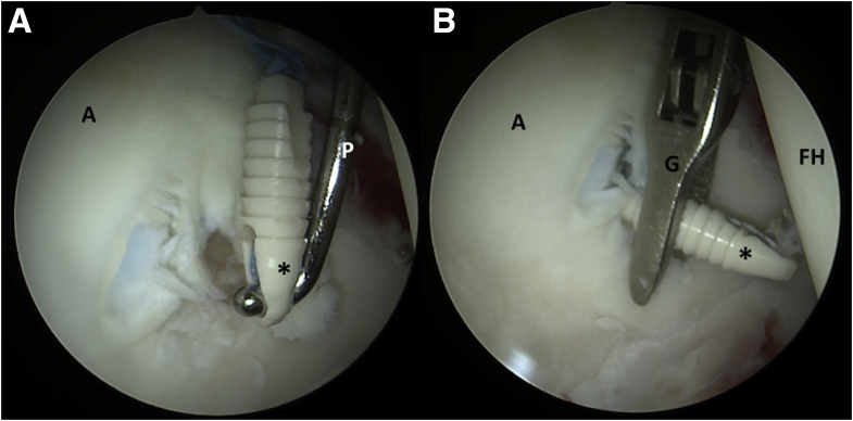 Fig 5