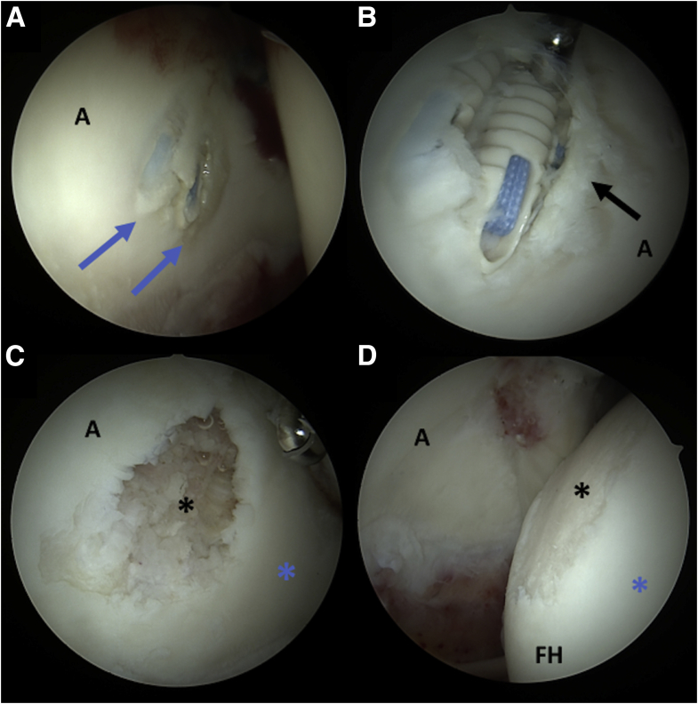 Fig 4