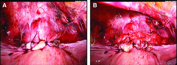 FIG. 13.