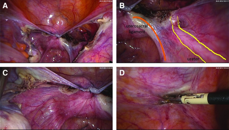 FIG. 14.