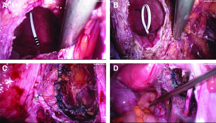 FIG. 15.