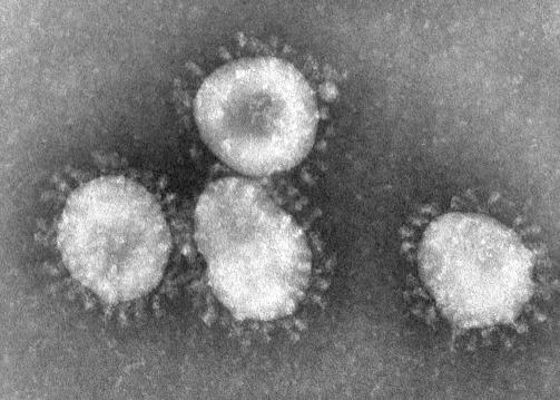 A coronavirus, with its distinctive halo or crown-like appearance, is recognized as the etiologic agent of the 2003 SARS outbreak