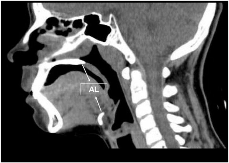 FIGURE 1