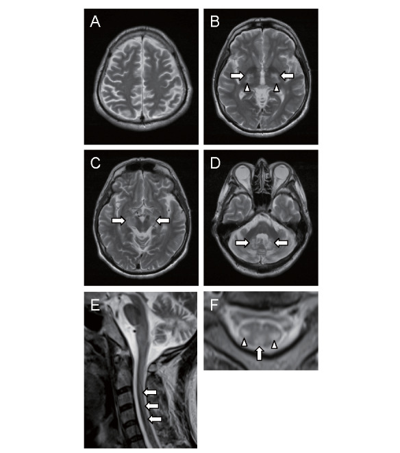 Fig.4. Brain magnetic resonance imaging (MRI)