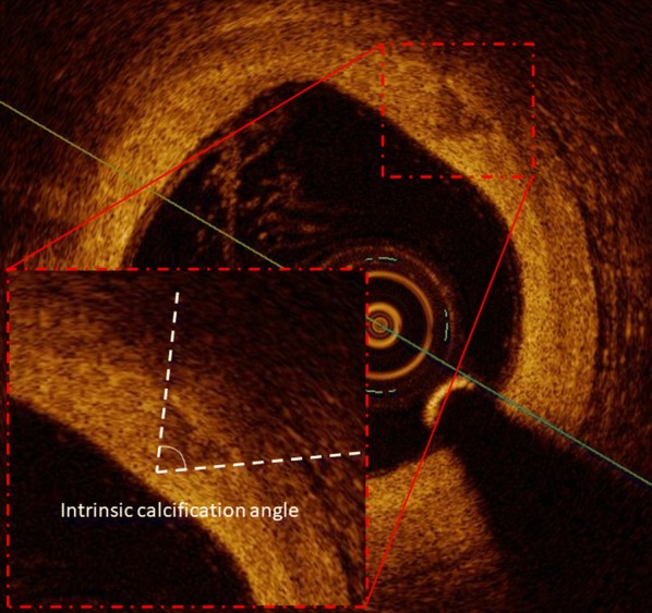 Fig. 1