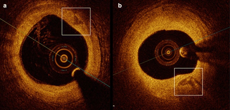 Fig. 2