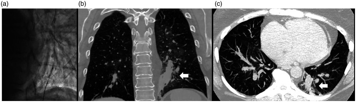 Fig. 4.