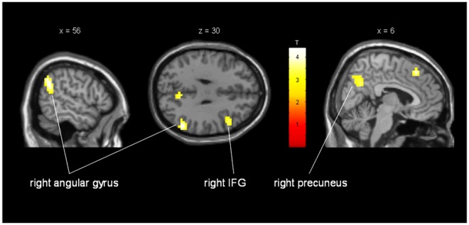 Fig 3