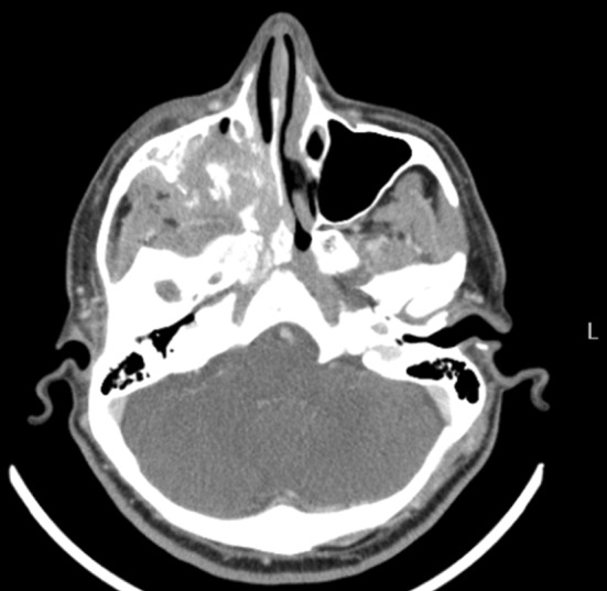 Fig. 3