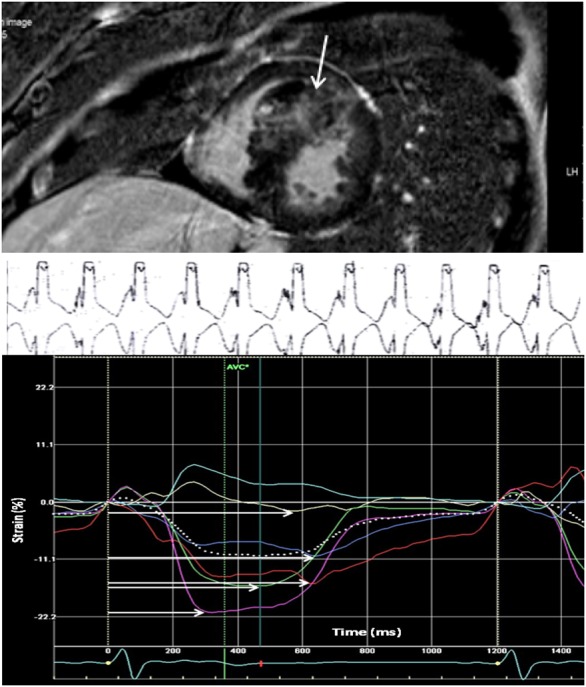 Figure 3