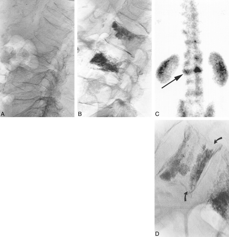 fig 2.