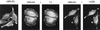 FIG. 5