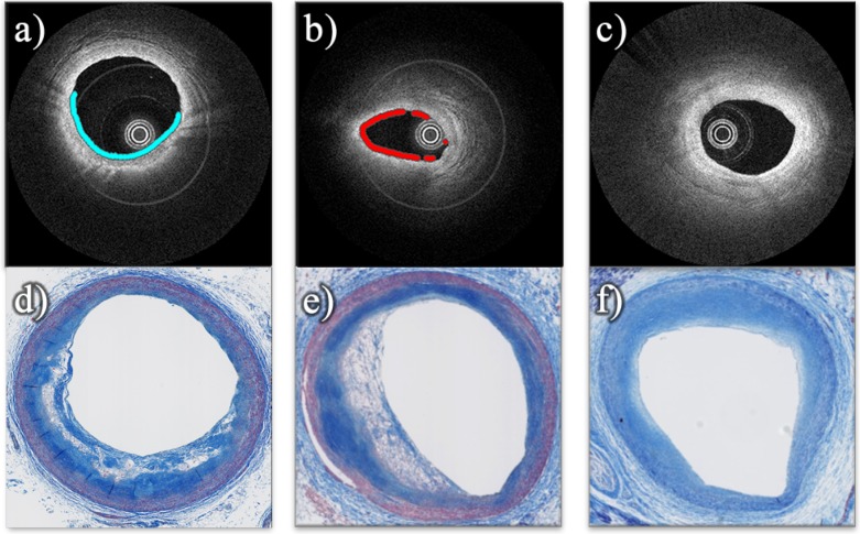 Fig. 12