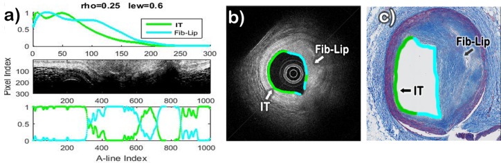 Fig. 11