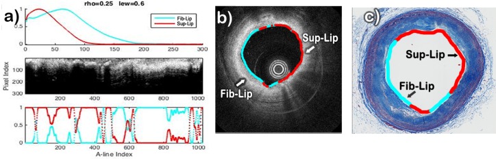 Fig. 10