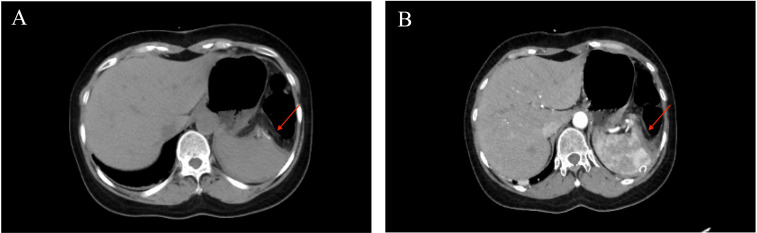 Figure 3