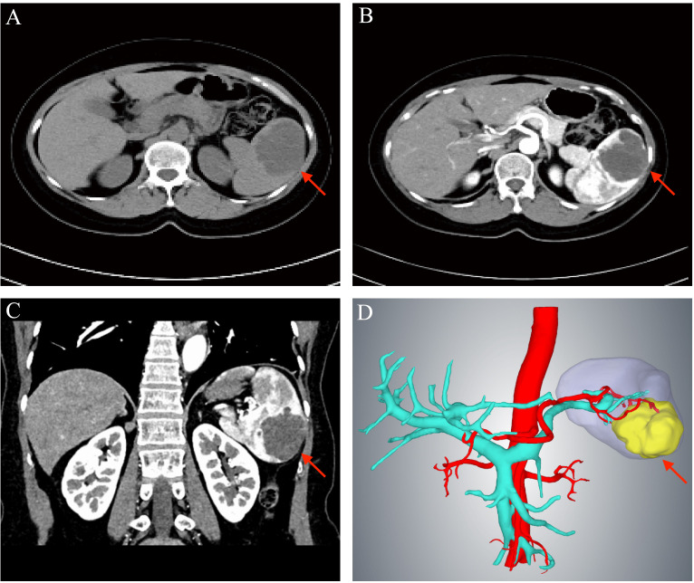 Figure 1