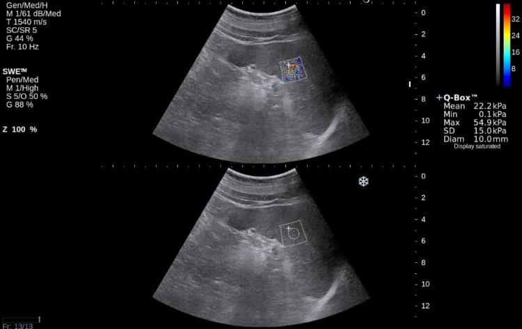 Fig. 1