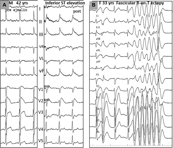 Figure 4