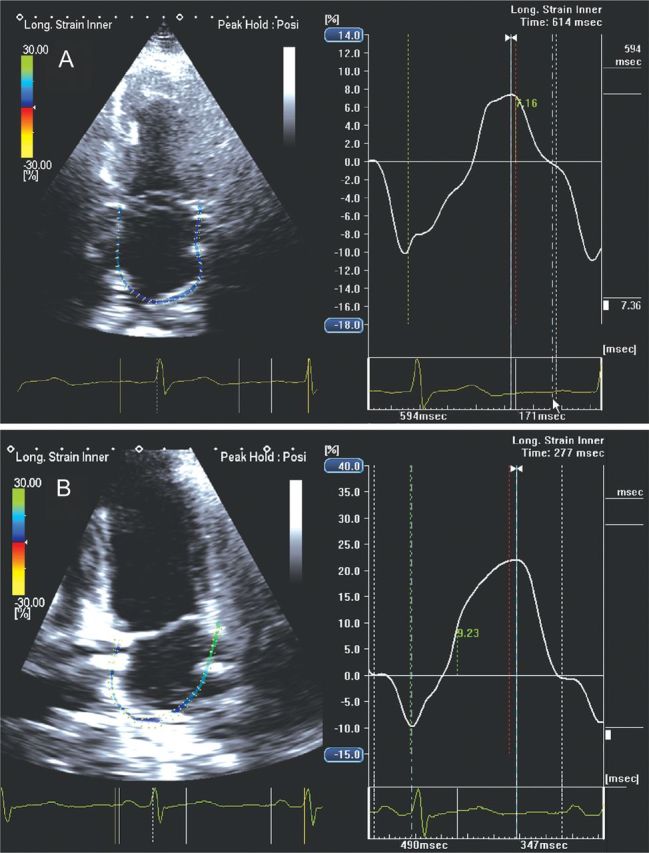 Figure 12