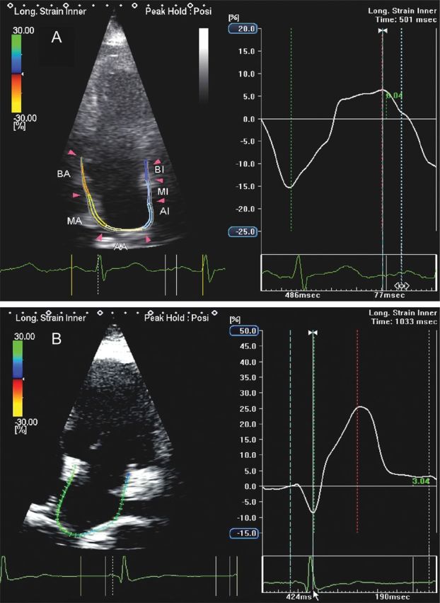 Figure 11