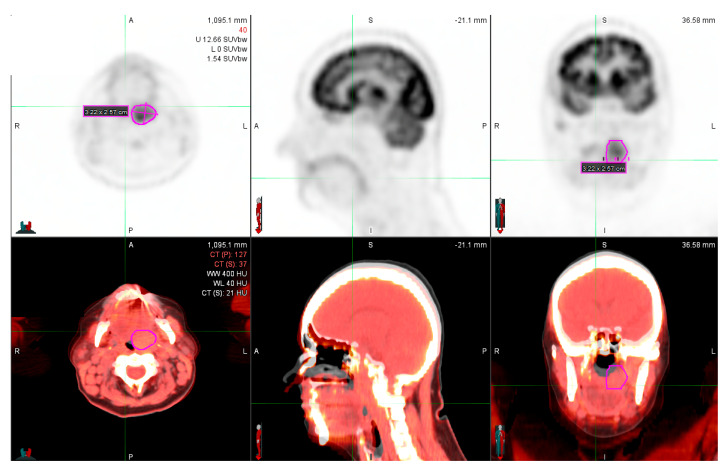 Figure 2