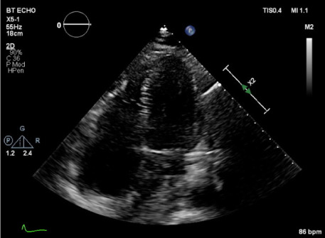 Fig. 5