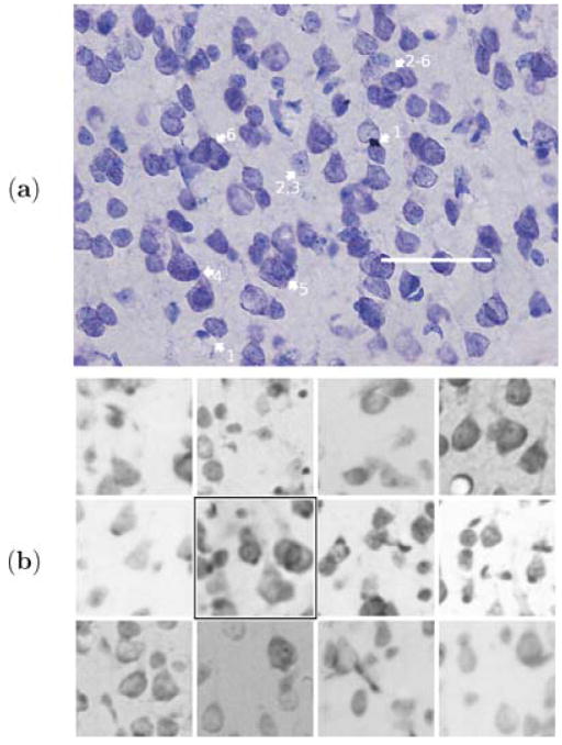 Fig. 2