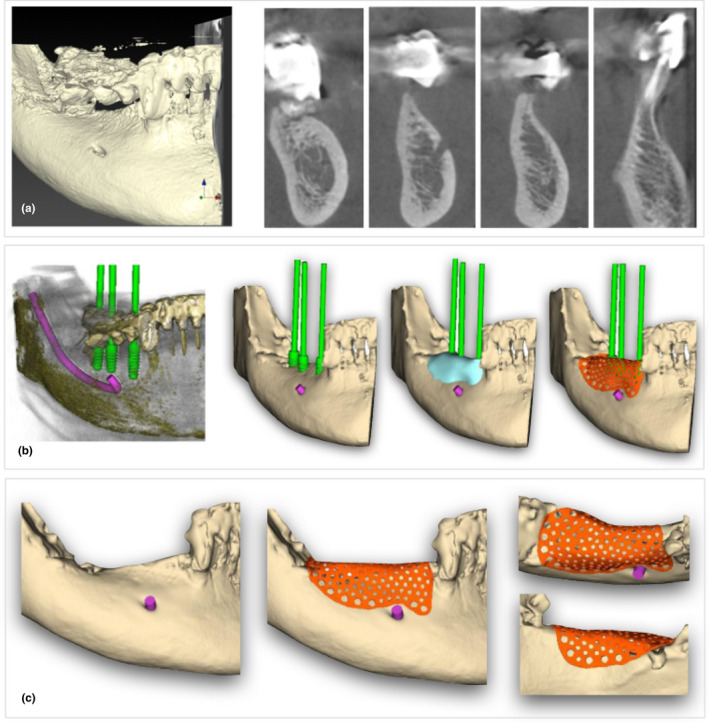 FIGURE 1