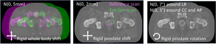 Fig. 1