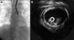 Fig 2