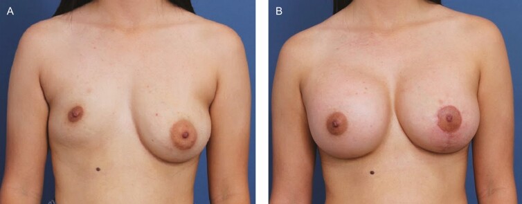 Figure 10.
