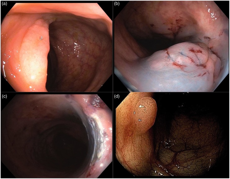 Figure 2.