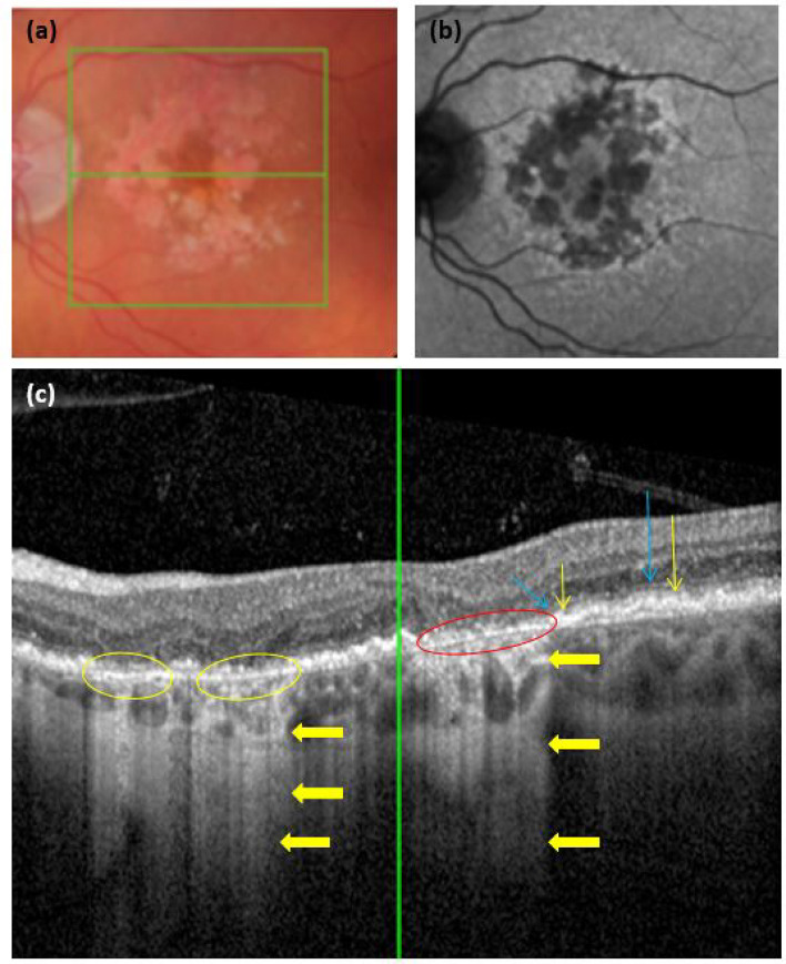 Fig. 2