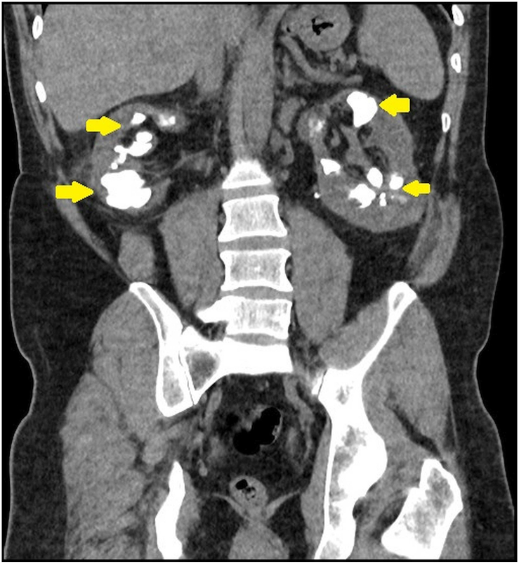 Fig. 2