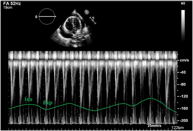 Figure 14