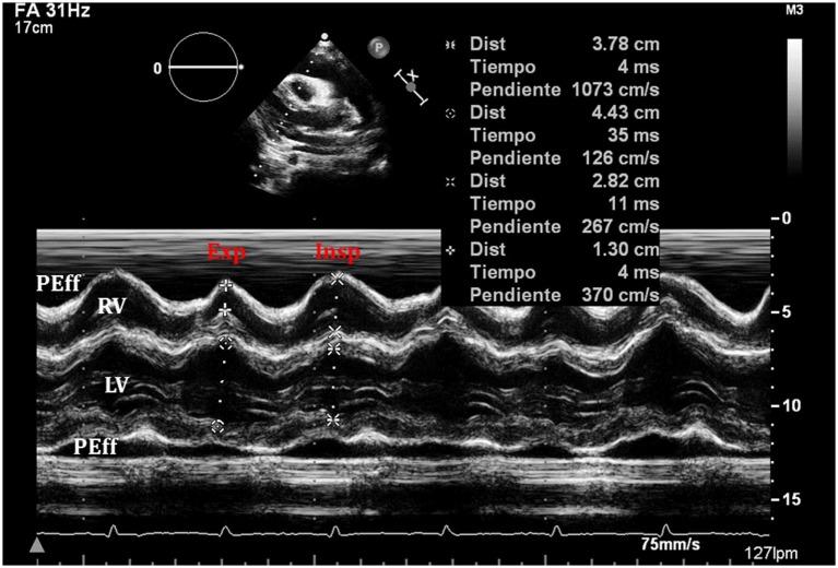 Figure 10