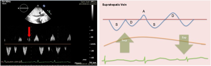 Figure 15