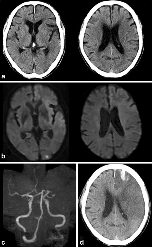 Fig. 2