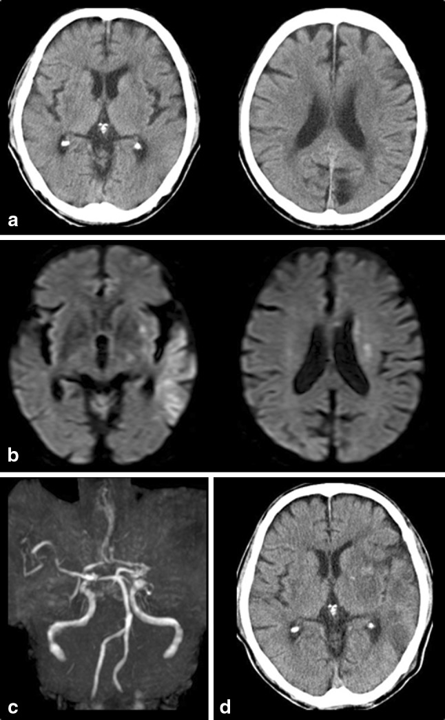 Fig. 1