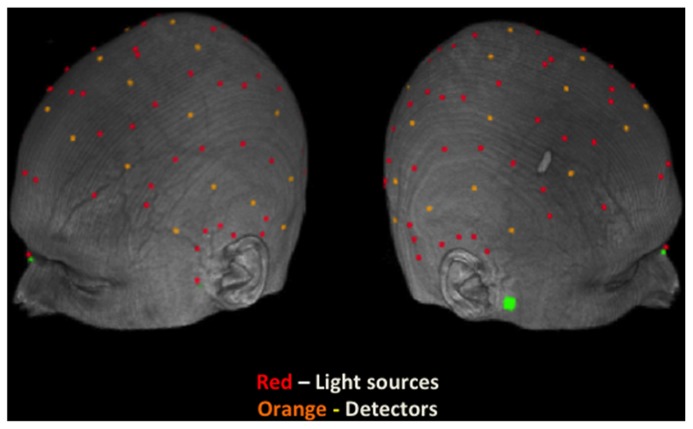 FIGURE 2