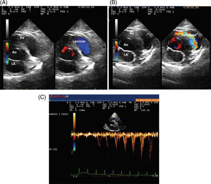 FIGURE 1