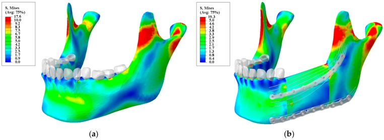 Figure 13