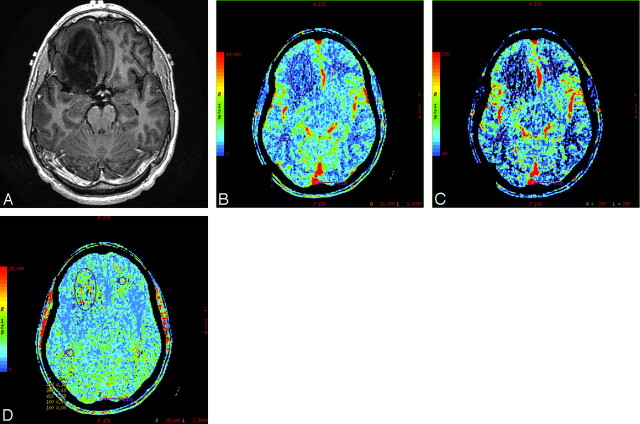 Fig 3.