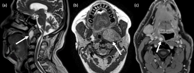 Figure 14.