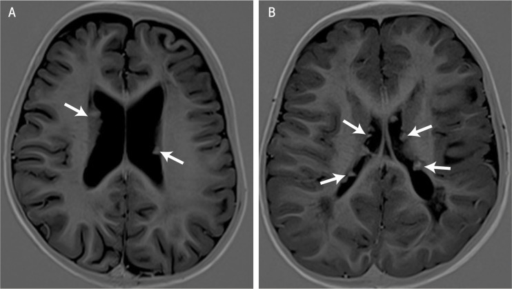 Figure 1A & B: